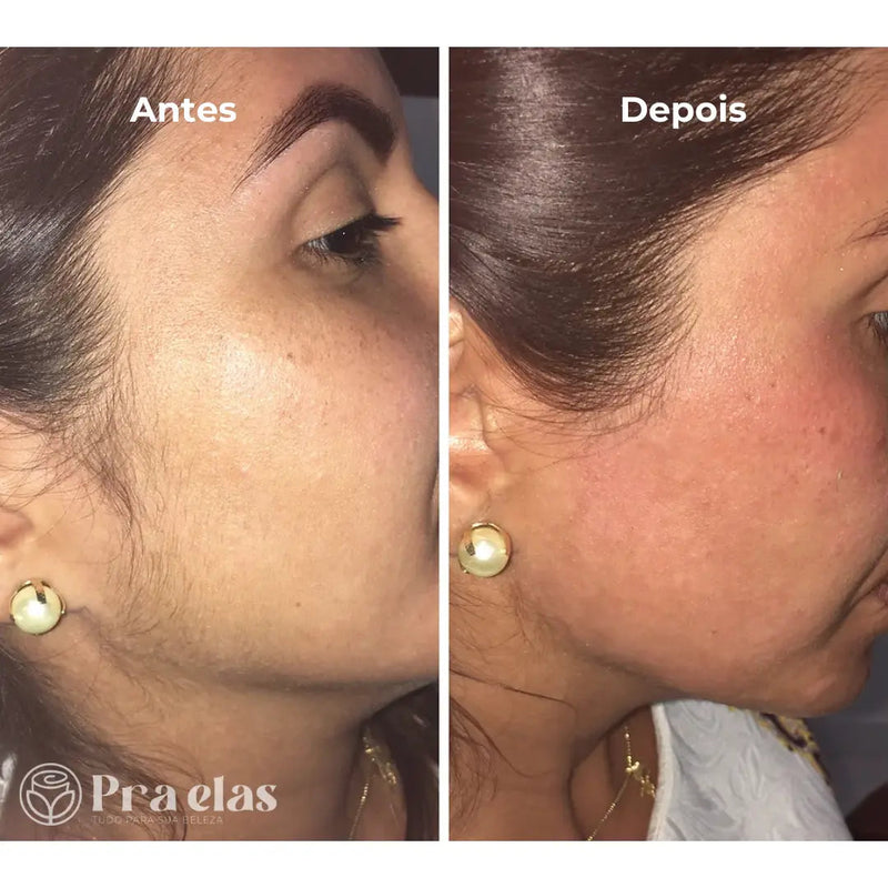 Caneta Depiladora Facial e Corporal + Cabo USB + Escova de limpeza