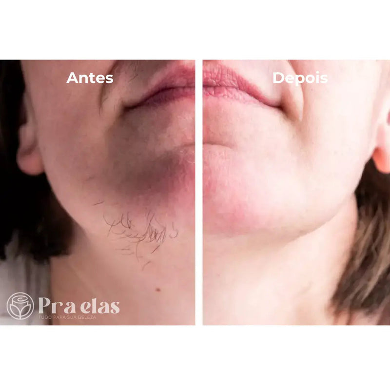 Caneta Depiladora Facial e Corporal + Cabo USB + Escova de limpeza